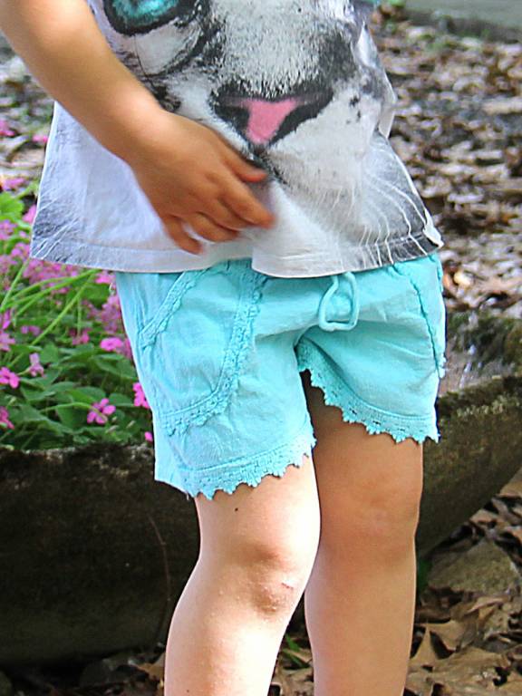 Kurze Hose für Mädchen Aurora